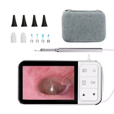 Otoscope numérique pour examen ORL