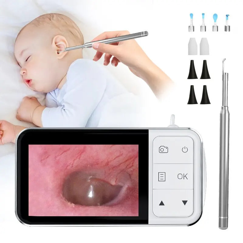 Otoscope numérique pour examen ORL