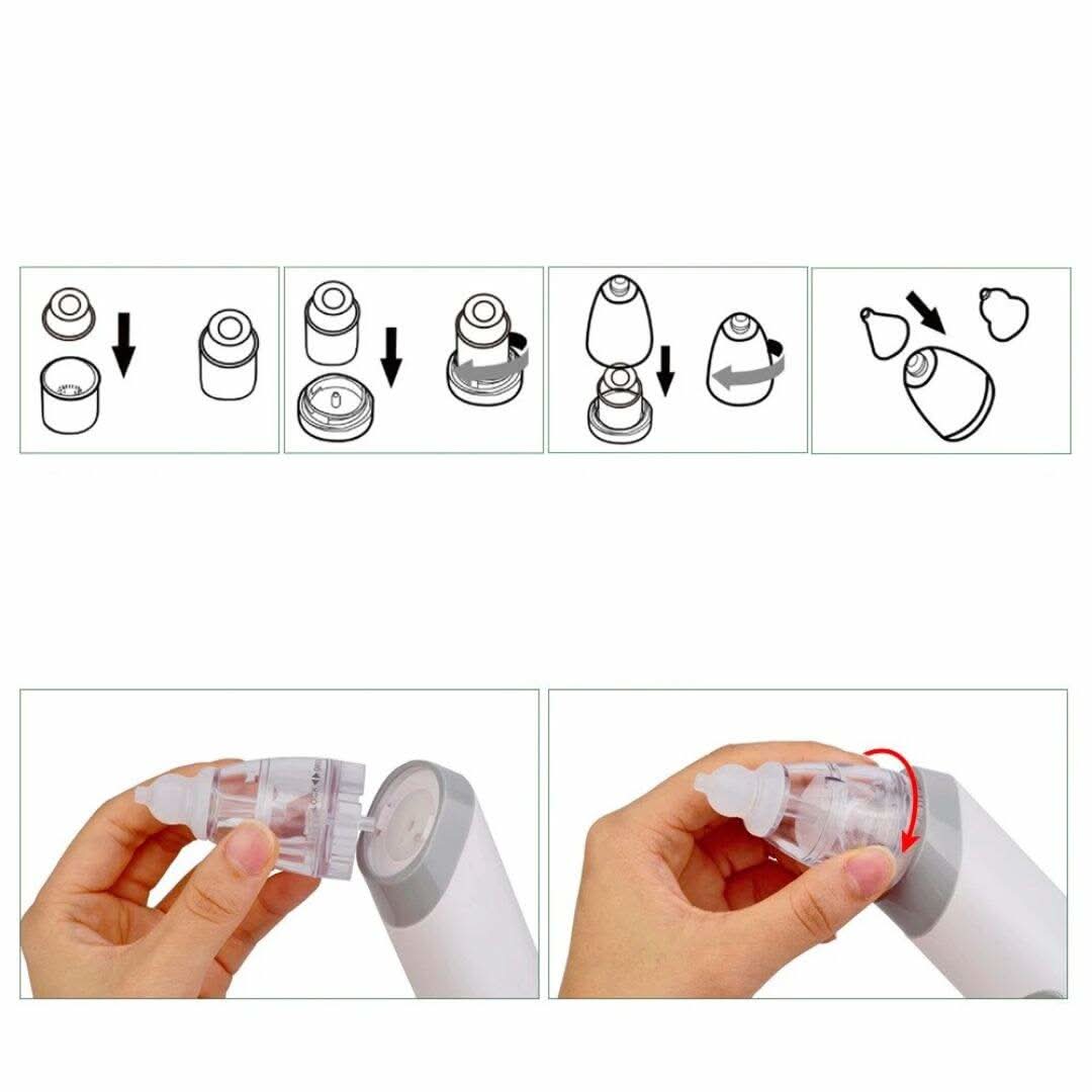 Mouche bébé électrique nettoyant nez bebe - Choupinoo