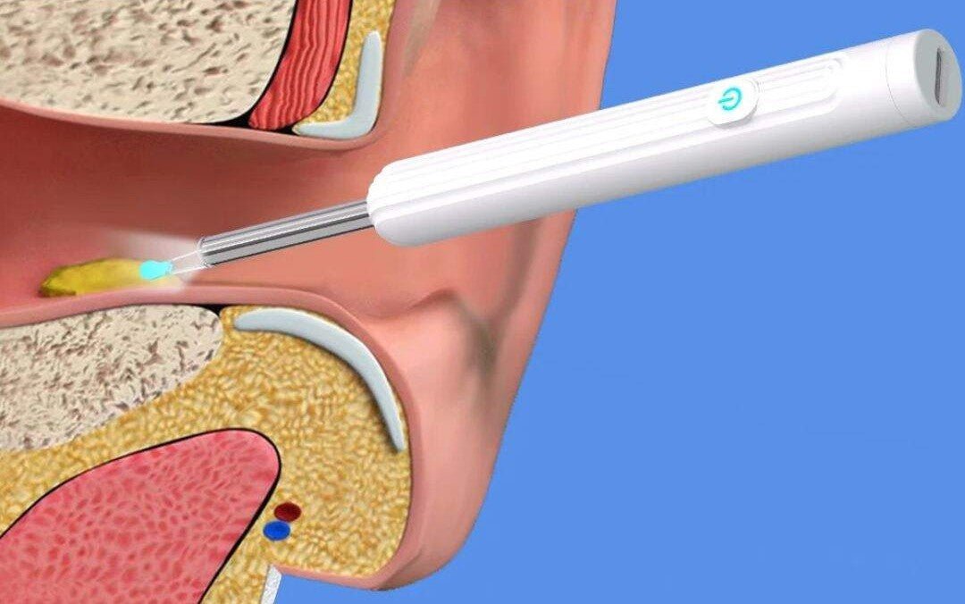 Cure oreille sans fil à camera et chargement USB - Choupinoo