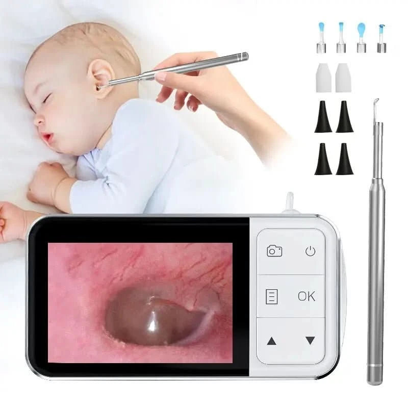 Otoscope numérique pour examen ORL - Choupinoo