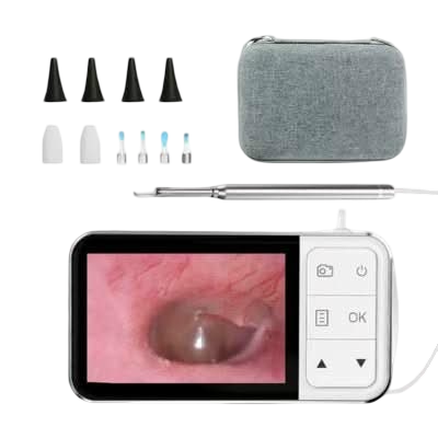 Otoscope Numérique avec Écran LCD et Caméra
